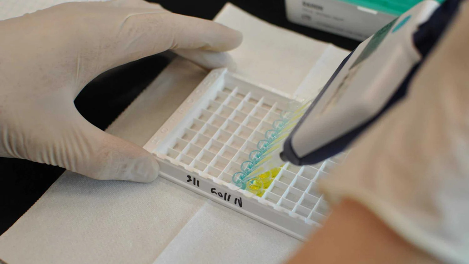 Choosing the Right ELISA Kit: Key Factors to Consider